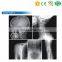 MY-D019B Portable Digital Integrated DR System X-Ray Generator