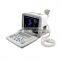 12.1 inch LED Display Portable Ultrasound Scanner Black and White Ultrasound Machine