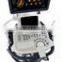 MC-DU-S40 High Class Comprehensive Trolley 3D 4D Color Doppler Ultrasound Scanner