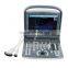 ECO1 100% good performance Ultrasound Scanner with 2.5-5.0MHz Convex probe carry bag Foot switch Sony UP897 optional