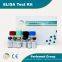 HYROID STIMULATING HORMONE (TSH) ENZYME IMMUNOASSY