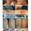 1 HZ The Highest Configure Tattoo Removal Machine Laser Marking Machine 1-10Hz