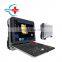 HC-A012F HD Image Portable 4D Color Doppler Ultrasound Equipment Scanner Machine Price /Portable 4D Ultrasound