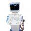 Medical Mobile Trolley Hospital Ultrasound Scanner Machine with Probe--RUS-9000C