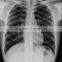 fuji film medical x-ray film 14*17in