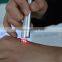new products 2016 innovative product 980nm diode laser spider vein removal beauty equipment