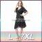 2016 sexy summer ladies lace dress hollow dress plus size for fat women