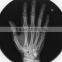 radiographic x ray digital radiography equipment medical x ray equipment digital xray film