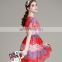 T-D069 Summer New Arrival Casual Trend Lace Contrast Color Women Dress