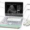 High Quality  Portable 15 inch Laptop Physical Therapy Medical Ultrasound Instruments Machine for Veterinary