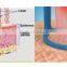 New Fractional CO2 Laser for Wrinkle Removal Skin Resurfacing laser co2 fractional