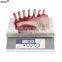 S7i-15K Stainless Steel Balance Scale