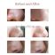 Micro Machine Facial Cleansing Portable Dermabrasion Machine for Blackhead Removal