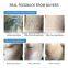 Q Switched ND Yag Laser Tattoo Removal Machine Eyebrow Pigment Freckles Blackhead Removal Skin Rejuvenation Beauty Instrument