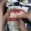 China Professional Dental Lab - Fast Delivery China Dental Lab