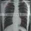 low price and good quality konida medical dry film made in china compatible fuji and agfa cr