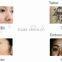 Q Switched Laser Machine EO Q-switch Nd Yag Facial Veins Treatment Laser Tattoo Removal Machine Tattoo Laser Removal Machine