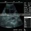 Sonostar 3D Built-in Battery Portable Vascular Cheapest Ultrasound Machine