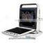 usb ultrasound probe USB ultrasound PC prob pc Ultrasound usb probe