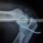 agfa red sensitive film X-ray film for hospital/agfa laser x ray film kodak medical x-ray film