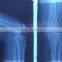 medical x-ray film blue sensitive 14*17inch