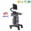 MY-A034A 100% quality guarantee Trolley Ultrasound scanner/USG/Medical Ultrasonography