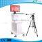 LT9802 used video colposcope supplier Electronic colposcope prices