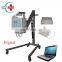 HC-D003A Medical Device 60mA Human Use X-ray Machine Portable Xray Machine Medical X-ray