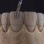 PFM-Bridges-Crowns  China Dental Laboratory - Outsourcing Dental Lab