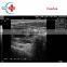 Original Mindray DP-2200PLUS  mindray portable ultrasound machine system with competitive price