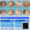 Spot Scar Pigment Removal FDA Approved Top Quality Doctor Use CO2 Fractional Laser/CO2 Laser Machine For Hospital Esthetic Beauty Spa Laser Clinics Skin Resurfacing Wrinkle Removal