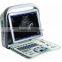 portable famous brand ultrasound machine SonoScape A6
