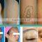 Newest 2016 ND Yag laser tattoo removal pigment removal laser equipment