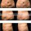 Promition! portable ultrasound machine cavitation