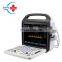 Top quality Full Digital portable echo ultrasound machine/ultrasound device