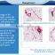 CE / FDA approved non-surgical 1cm2 spot size best cellulite hifu slimming machine body good effect removal machine