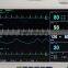 New Portable Multiparameter Patient Monitor With Good Service