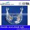 Hot Sale Transparant Mandibule Implant Model