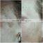 Best Matrix rf Fractional With Microneedle Machine for Wrinkle Removal
