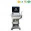 MY-A009 Crystal-clear Image 15inch screen PC based laptop ultrasound B scanner