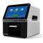 Mini blood test machine hematology machine dry analyser