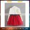 2016 New arrival factory direct sale pretty girls party dresses fashion kids tutu dress