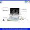 Portable Ultrasound Device