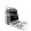 MY-A026 Medical cheap laptop high performance portable personal full digital color doppler ultrasound price
