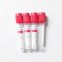 plain blood tube red top blood tube blood test tube