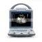 Portable medical black and white ultrasound machine Full digital diagnostic ultrasound