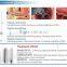 40W RF Excited Fractional Co2 Surgical Laser Vaginal Rejuvenation / Stretch Marks Removal / Laser Vaginal Tightening