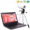 MY-F003 medical apparatus portable beautiful vagina colposcope electronic digital video colposcope for gynecology