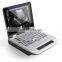 Portable Notebook Color Doppler Ultrasound Scanner medical machine Equipment