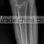 x-ray film with low price x-ray film digital film medical x-ray film